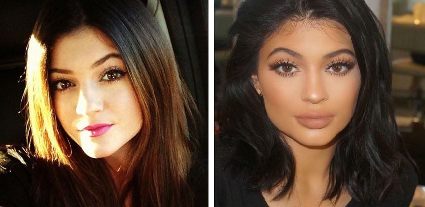 A Timeline of Kylie Jenner’s Transformation Over the Years